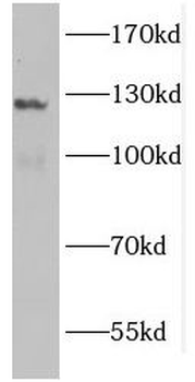 GUCY2F Antibody