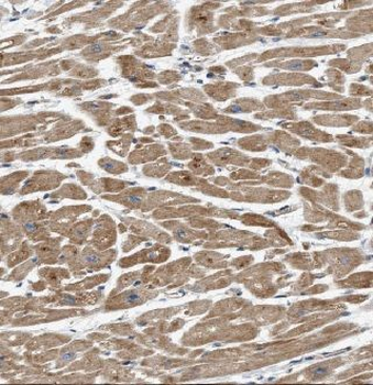 GUCY2F Rabbit Polyclonal Antibody