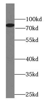 HAL Rabbit Polyclonal Antibody