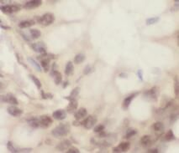 HAL Rabbit Polyclonal Antibody
