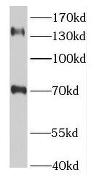 TSC1 Rabbit Polyclonal Antibody