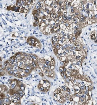 USH1C Rabbit Polyclonal Antibody