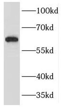 HAUS3 Rabbit Polyclonal Antibody