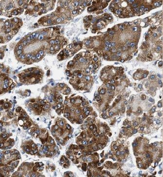 HAUS3 Rabbit Polyclonal Antibody