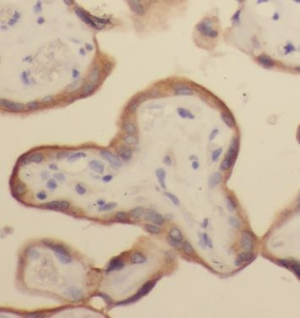 HAUS4 Rabbit Polyclonal Antibody