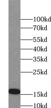 HBG1 Rabbit Polyclonal Antibody