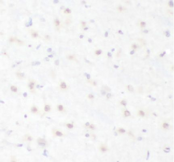 HBG1 Rabbit Polyclonal Antibody