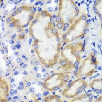 HCLS1 Rabbit Polyclonal Antibody