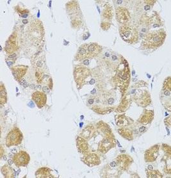 HDAC4 Rabbit Polyclonal Antibody