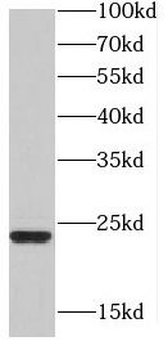 HDDC2 Antibody