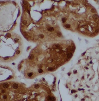 HDDC3 Rabbit Polyclonal Antibody