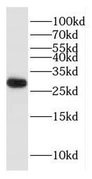 HDHD3 Antibody