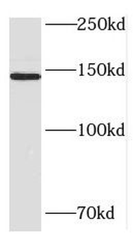 HDLBP Antibody
