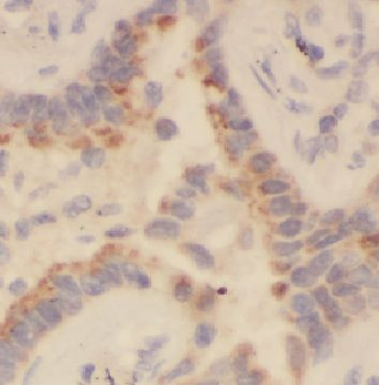 DNAAF5 Rabbit Polyclonal Antibody