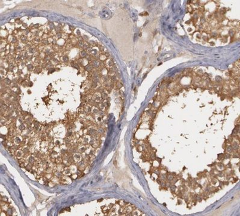 HEATR4 Antibody