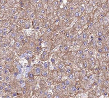 HEBP1 Rabbit Polyclonal Antibody