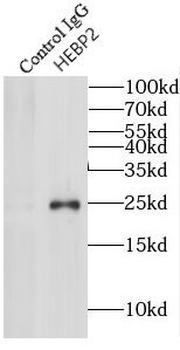 HEBP2 Rabbit Polyclonal Antibody
