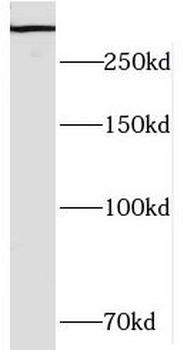 HECTD1 Antibody