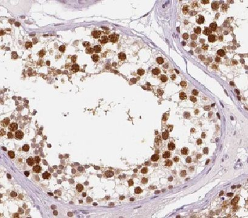 HEMGN Rabbit Polyclonal Antibody