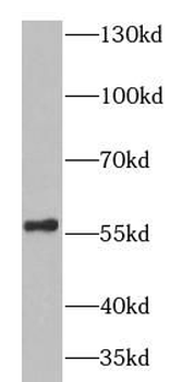 HEXA Rabbit Polyclonal Antibody