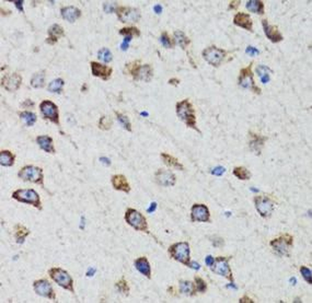 HEXA Rabbit Polyclonal Antibody