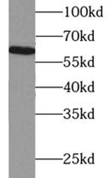 HEXB Rabbit Polyclonal Antibody