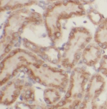 HEXB Rabbit Polyclonal Antibody