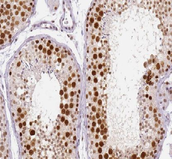 HEXIM2 Rabbit Polyclonal Antibody