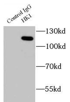 HK1 Rabbit Polyclonal Antibody