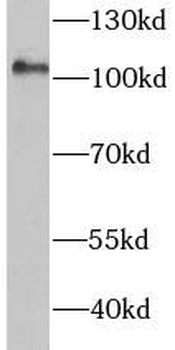HK2 Antibody