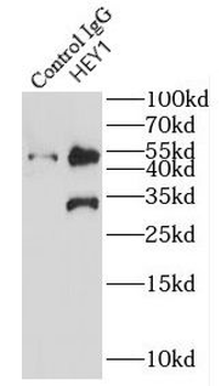 HEY1 Rabbit Polyclonal Antibody