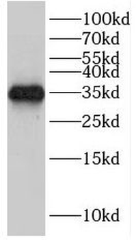 HEY2 Antibody