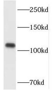 HGS Rabbit Polyclonal Antibody