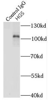 HGS Rabbit Polyclonal Antibody