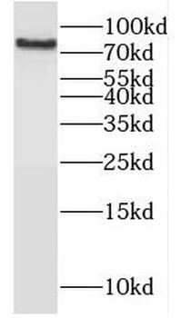 HHIP Antibody