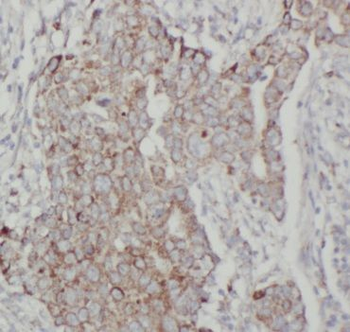 HHIP Rabbit Polyclonal Antibody