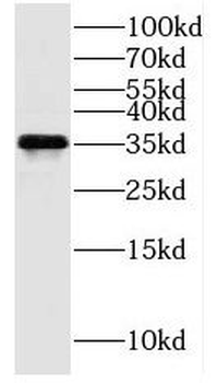 HIBADH Rabbit Polyclonal Antibody