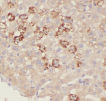 HIBADH Rabbit Polyclonal Antibody