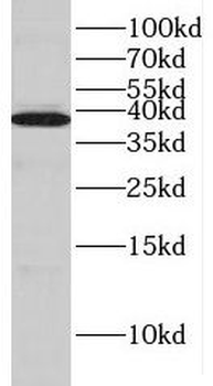 HIBCH Antibody