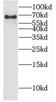 HIC1 Antibody