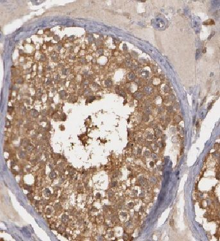 HIGD1A Rabbit Polyclonal Antibody