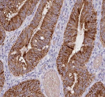 HIGD1B Antibody