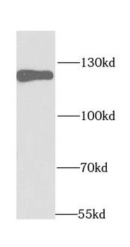 HIP1 Antibody