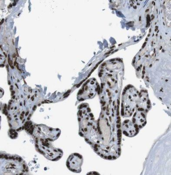 HIP1R Rabbit Polyclonal Antibody