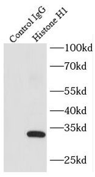 Histone H1 Rabbit Polyclonal Antibody