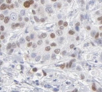 H2AX Rabbit Polyclonal Antibody