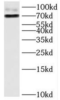 HJURP Antibody