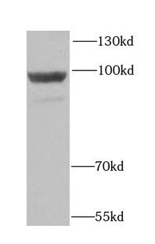 HK3 Antibody