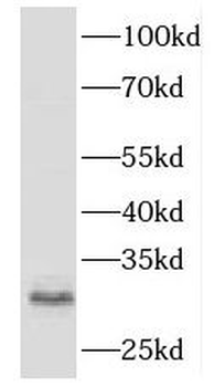 HLA-DRB5 Antibody