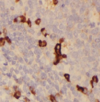 HLA DRB5 Rabbit Polyclonal Antibody